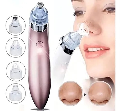 REMOVEDOR DE PUNTOS NEGROS